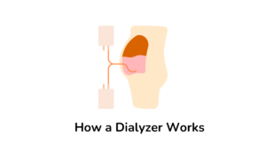 How a Dialyzer Works - Step by Step. - Medocal Limited